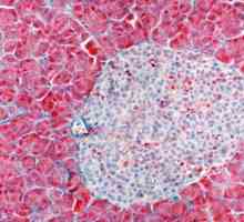 И во клетките на панкреасот (алфа, бета), антитела - нивната регенерација и трансплантација