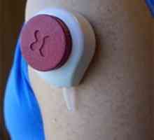 Крвниот тест без болка од страна на вакуум