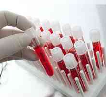 Тестови на крвта за opistorhoz (IFA, биохемија), антитела (АТМ)
