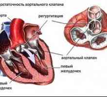 Аортна срцева болест: третман, симптоми, знаци, причини