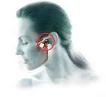 Артритис на temporomandibular заеднички: третман, симптомите, дијагноза