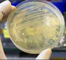 Биохемиска анализа на фекална прекумерен раст бактерии