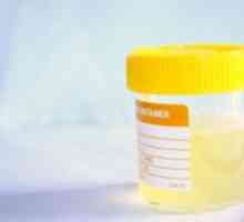 Биохемиска анализа на урина