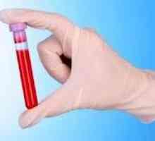 Крв биохемија на панкреасот со панкреатитис