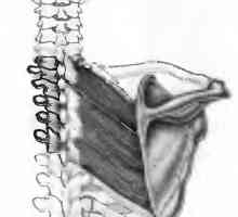Болки во грбот предизвикани од ромбоидни мускули