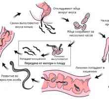 Чести инфекции (црв наезда) pinworms (enterobiasis) човек