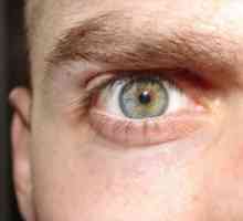 CMV ретинитис: симптоми, третман, дијагноза, превенција