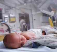 Дијафрагмална хернија дефекти кај новороденчињата