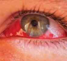 Hemophthalmus очите третман, предизвикува, класификација, симптомите