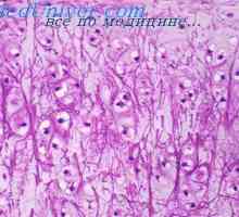 Histogenesis коските на ембрионот. Мембранозната коските на фетусот