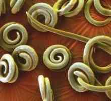 Паразитски наезда со pinworms: третман, симптомите