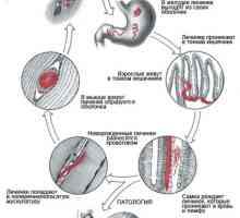 Хелминти (црви) кои живеат во човечките мускули, симптомите и фотографии