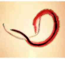 Црви во урината (мочниот меур) кај деца и возрасни