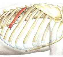 Хируршки пристапи за торакална 'рбетот