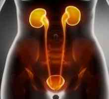 Инфекции на уринарниот тракт кај жените, симптоми, третманот, причините, симптомите