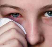 Инфективни болести на очите орбита