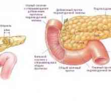 Инсулином рак на панкреасот: симптоми, дијагноза, третман, симптоми, причини