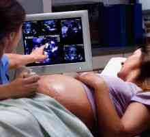 Вештачки биолошките валвули во бременоста