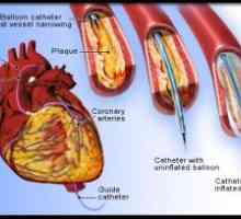 Една студија на артериите