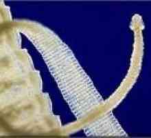 Протерување на црви од човечкото тело, како и побрзо протерување на хелминти?