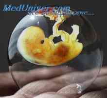 Промени во матката за време на имплантација. Структурата на плацентата