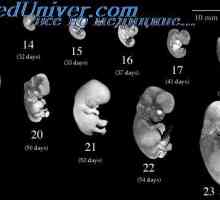 Ембриологија во медицинското образование. Проблеми ембриологија настава