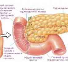 Ендокрини тумор на панкреасот