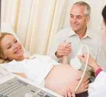 Епидуралната анестезија за време на породувањето, ефекти и контраиндикации