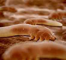 Како црви влијае на човечкото тело?