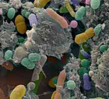 Што тестови помине на dysbacteriosis?
