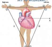 Vectorcardiogram. Електрични оска на срцето