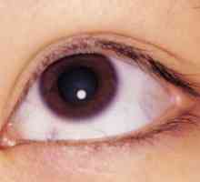 Граница кератитис око: третман, причините, симптомите