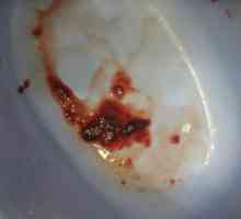 Крв во столицата со црви