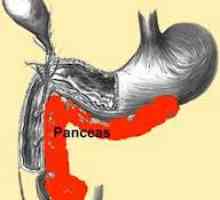 Третман на панкреатит (на панкреасот) во акутна фаза