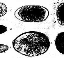Roundworm ларви миграција, развојот на човечкото тело