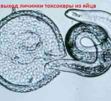 Ларви и јајца Toxocara висцерална токсокаријаза