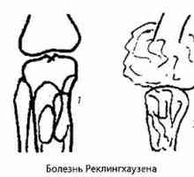 Зрачење и инструментални дијагноза на коленото заеднички патологија. артритис