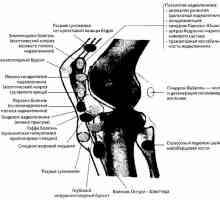 Зрачење и инструментални дијагноза на коленото заеднички патологија