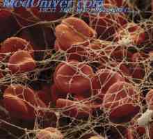 Полицитемија влијание врз циркулацијата на крвта. Бели крвни клетки се бели крвни клетки