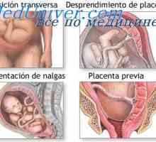 Механизми на почетокот на породувањето. Хормони влијаат на матката