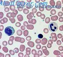 Уништувањето на хемоглобинот. различни анемија