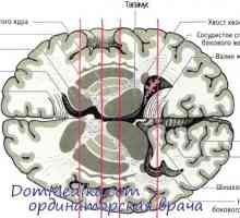Невротрансмитерите се базалните ганглии. Паркинсонова болест