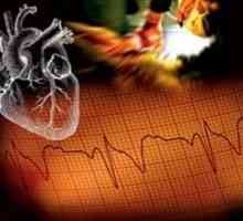 Итни случаи во кардиологија: третман