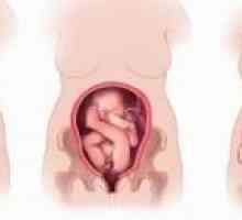 Погрешна позиција и презентација на фетусот за време на бременоста