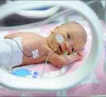 Невролошки развој и невролошки рехабилитација на предвремено родени бебиња