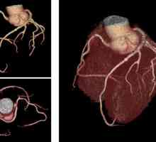 Новиот КТ скенер за arineta вниманието КТ срце ќе одат во клиниката САД
