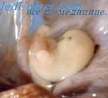 FIELD нозе фетусот мозокот. Epithalamus феталниот развој