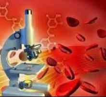 Комплетна крвна слика со панкреатитис, леукоцити, СЕ