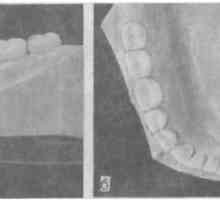 Проценка на состојбата на забите