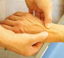 Остеоартритис на рачниот зглоб: Третман, Причини, Симптоми, знаци